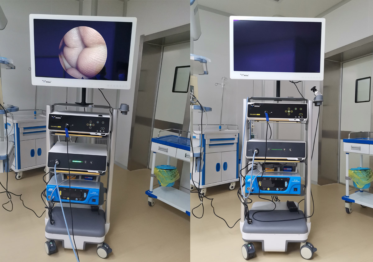 益柯達一體化內(nèi)窺鏡影像系統(tǒng)裝機 益柯達一體化內(nèi)窺鏡影像系統(tǒng)裝機